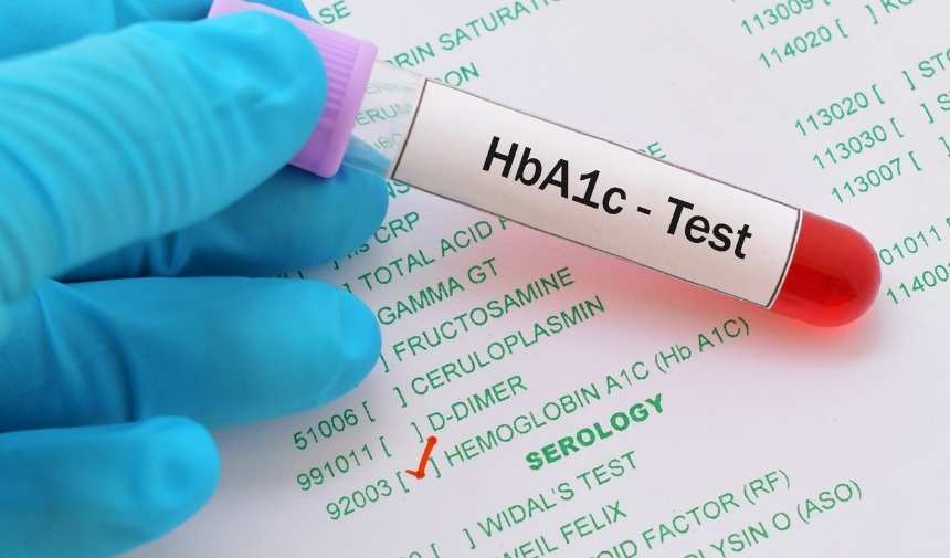 Diyabet Yönetiminde Hba1C Testi