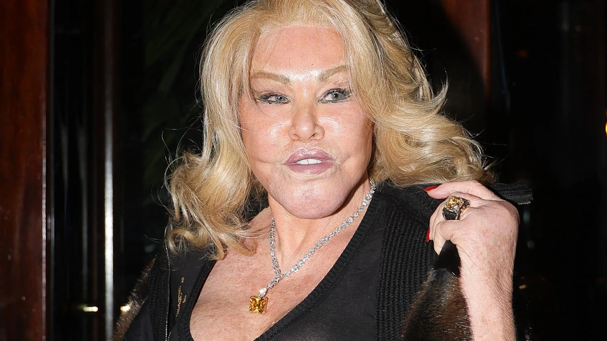 Kedi Kadın Jocelyn Wildenstein 84 Yaşında Öldü