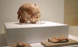 Dünyanın ilk beyin ameliyatına ait kafatası sergilendi 