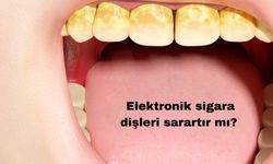 Elektronik sigara dişleri sarartır mı?