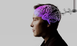 Neuralink'in ilk insan deneyi başarısız oldu: Beyin çipi kafasından çıktı