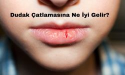 Dudak Çatlamasına Ne İyi Gelir?