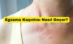 Egzama Kaşıntısı Nasıl Geçer?