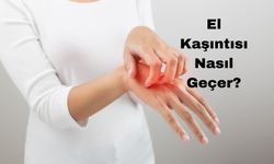 El Kaşıntısı Nasıl Geçer?