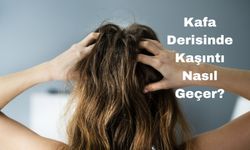 Kafa Derisinde Kaşıntı Nasıl Geçer?