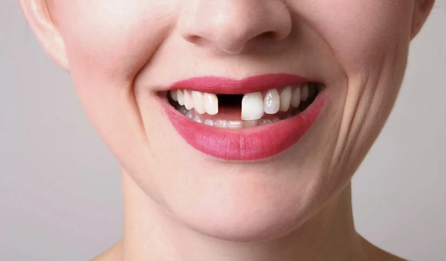 Diş eksikliği yaşayanlara ilaç olacak! Dişleri yeniden büyütecek bir keşif yapıldı...